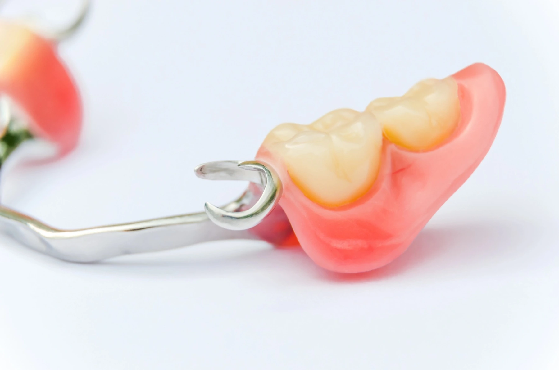 Illustrative removable partial denture.